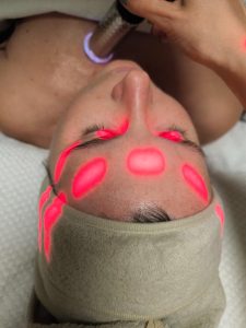 Laser a karboxyterapie, Ošetření biostimulačním laserem a karboxyterapie ve studiu Checa Belleza Opava